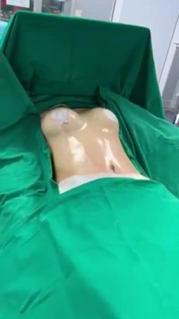 VÒNG 1, VÒNG 2 ĐẸP NHƯ MƠ CỦA CHỊ KHÁCH 33 TUỔI SAU KHI THỰC HIỆN COMBO THẨM MỸ TẠI JK