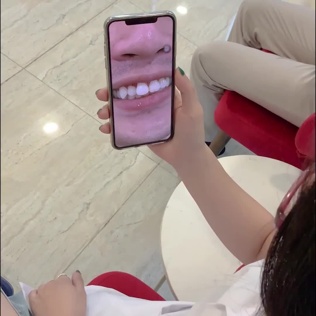 FEEDBACK CỦA KHÁCH HÀNG SAU 2 THÁNG BỌC RĂNG