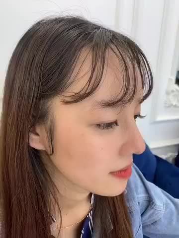 Bất ngờ với dáng mũi cấu trúc lót megaderm sau 1 tháng, quá xinh quá xuất sắc