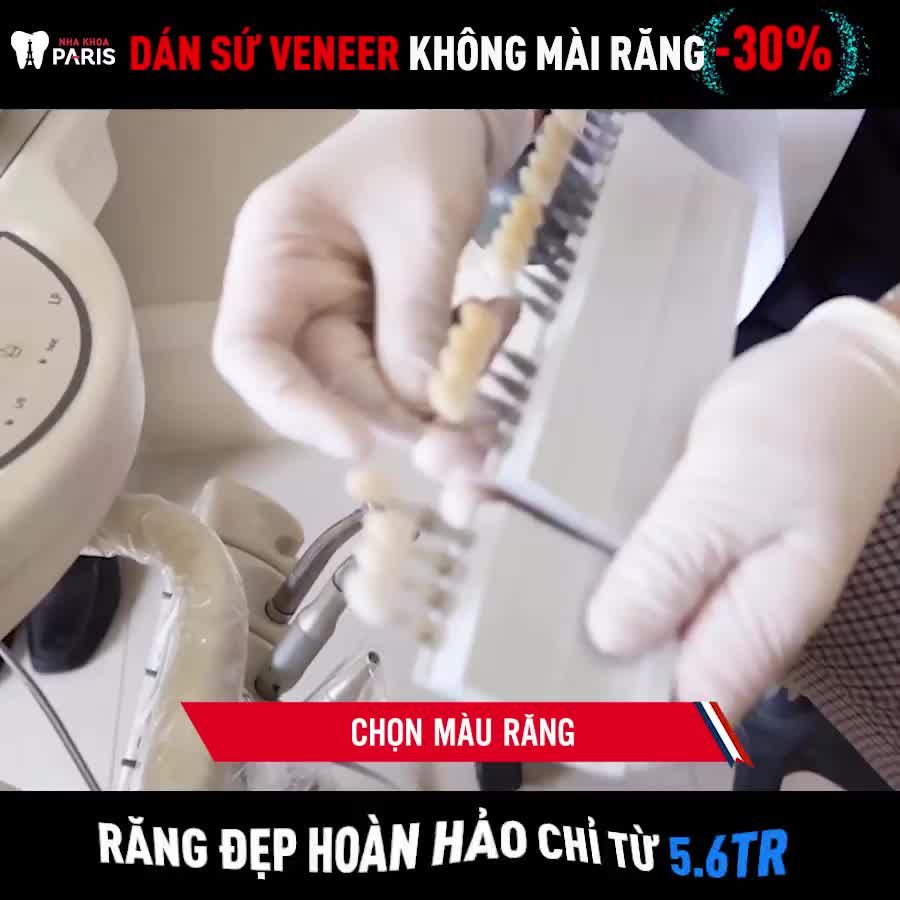 Cận cảnh quy trình Dán Sứ Veneer Không Mài Nhỏ răng
