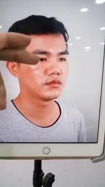 NÂNG MŨI CẤU TRÚC CHO NAM – MŨI ĐẸP CHUẨN MEN