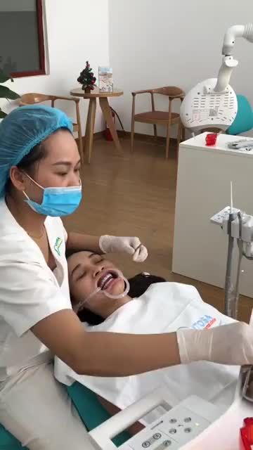 TẨY TRẮNG RĂNG HẾT Ố VÀNG CHỈ TRONG 1H