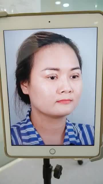 DÁNG MŨI CẤU TRÚC VỪA ĐƯỢC DR HOẠT THỰC HIỆN XONG