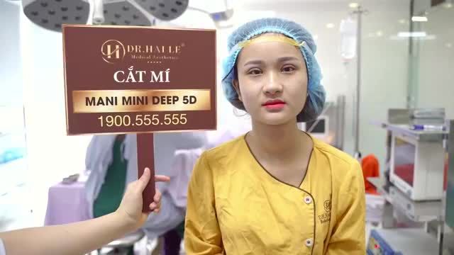 Ngỡ ngàng với kết quả thay đổi sau khi Cắt mí Mani Mini Deep 5D đẹp tức thì - Ít sưng - Không đau