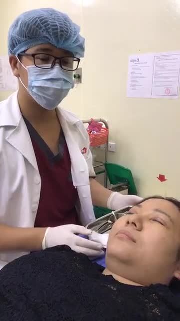Sau 5 NGÀY Mí đã sắc nét, TỰ NHIÊN hài hòa