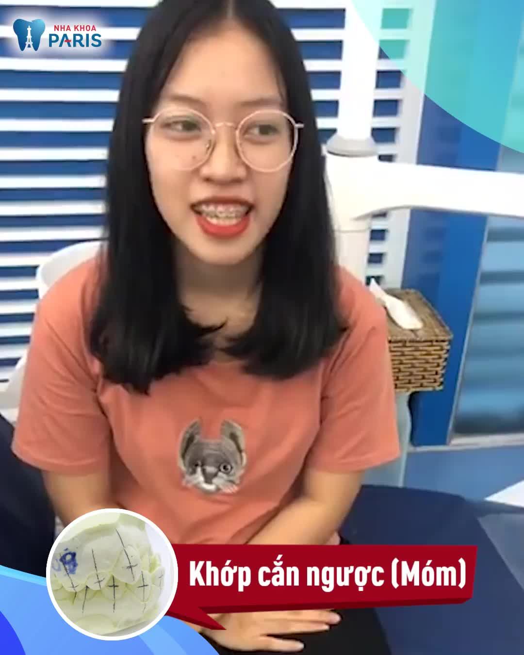 10 THÁNG NIỀNG RĂNG THAY ĐỔI THẾ NÀO
