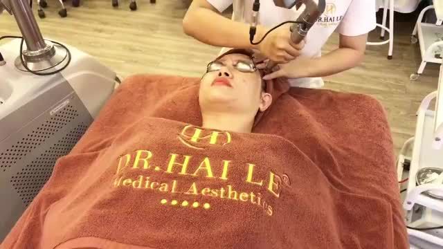 Điều trị nám bằng Laser Diamond Square tại Dr.Hải Lê