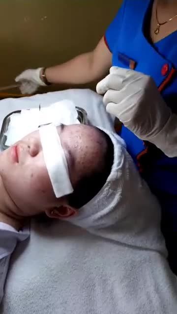MỤN Ư CHUYỆN NHỎ ĐÃ CÓ KANGNAM LO