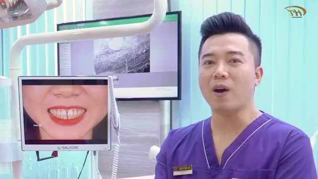 Động lực nào mà khách hàng xinh đẹp sinh sống tại Đài Loan về Việt Nam để làm răng sứ.