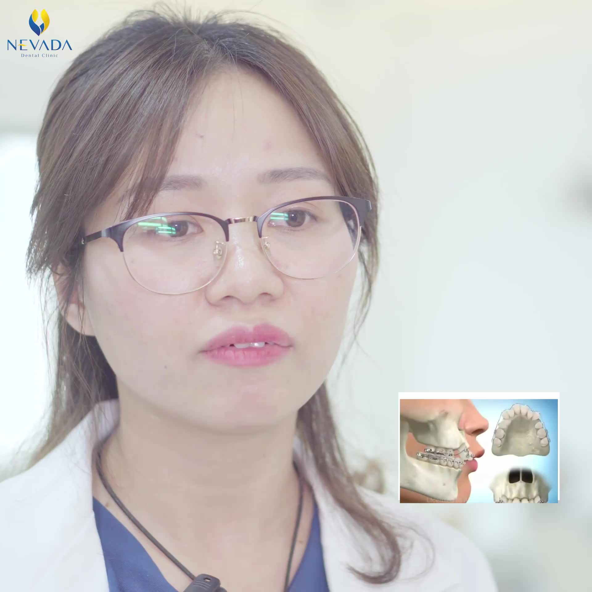 Niềng răng/ Chỉnh nha được xem là giải pháp nắn chỉnh răng được ưa chuộng nhất hiện nay