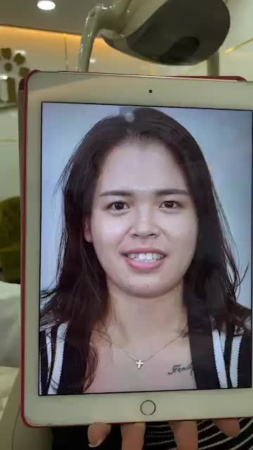 VƯỢT NGÀN CÂY SỐ TỪ ĐỨC VỀ VIỆT NAM ĐỂ THẨM MỸ RĂNG SỨ TẠI DELIA