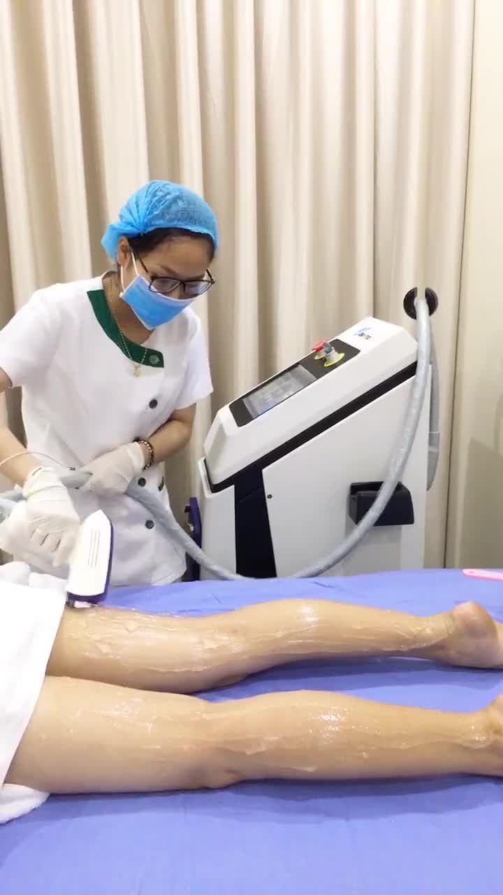 Nang lông mỏng dần sau 6 buổi triệt lông Diode Laser