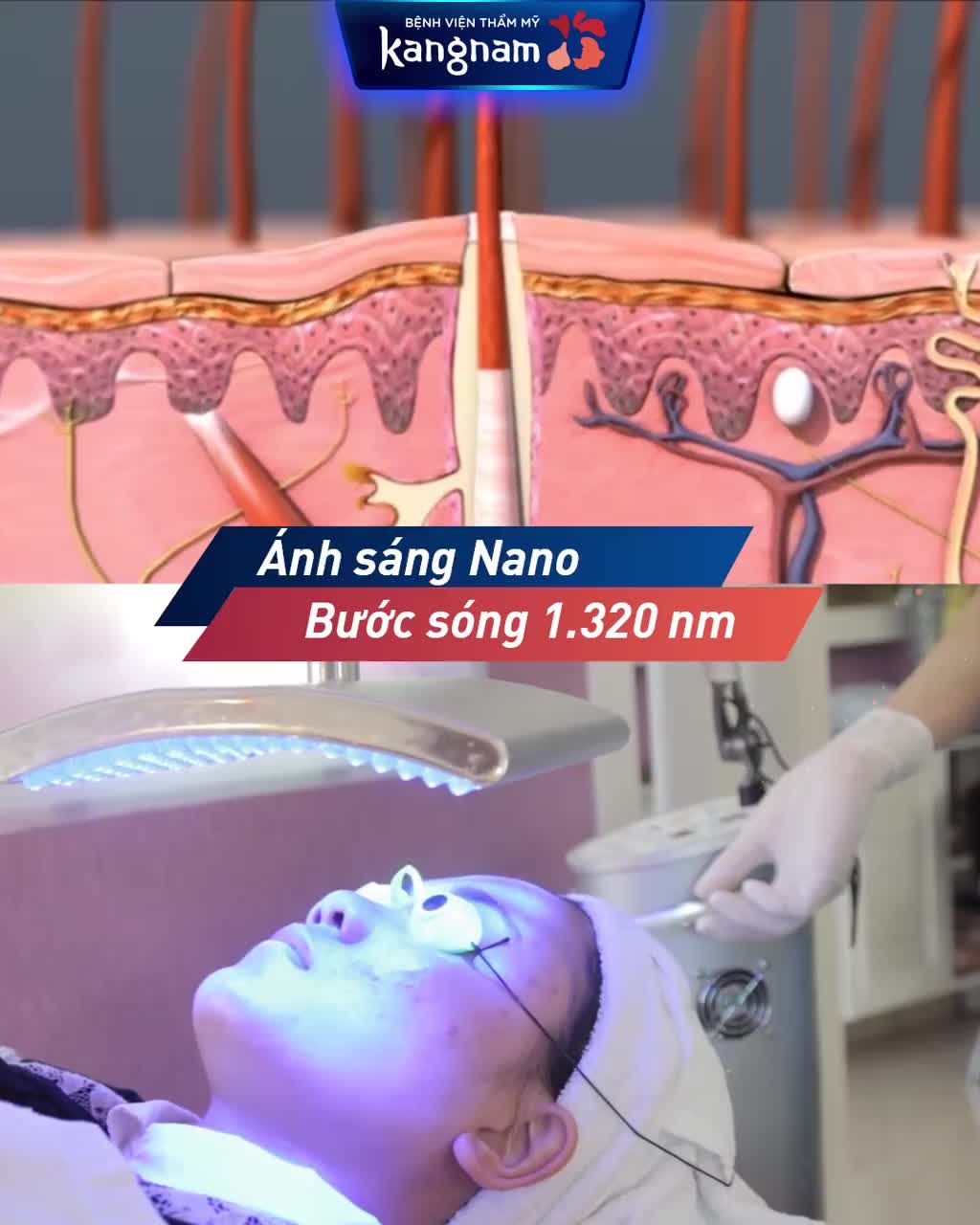 MỤN LÂU NĂM? CHỮA MÃI KHÔNG KHỎI