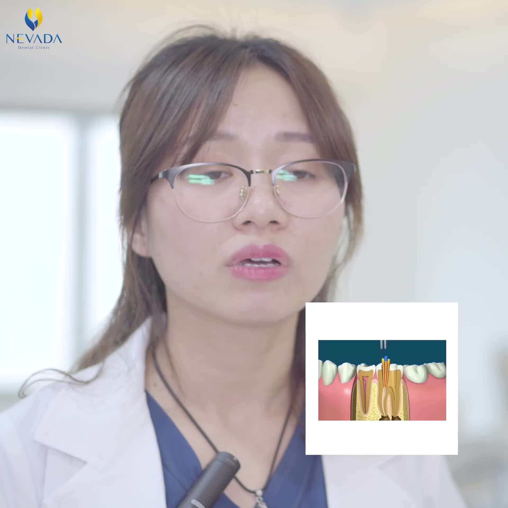 Răng sứ thẩm mỹ được giới chuyên gia đánh giá là giải pháp phục hình nha khoa hiệu quả  được ưa chuộng nhất hiện nay