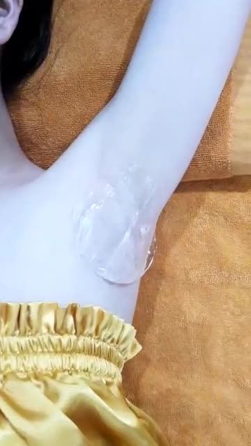 Triệt lông nách CN DIODE LASER của khách hàng tại Kangnam