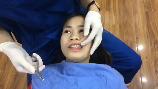 Thời khắc mà các bạn chỉnh nha luôn mong đợi.