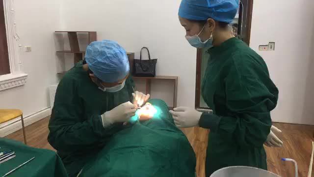cấy chân răng nhân tạo implant cho chị Hằng phục hồi R17 bị mất tại Nha Khoa Thuỳ Anh.