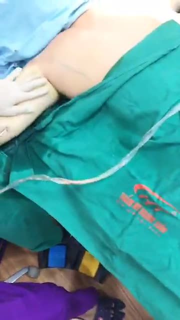 Sản xuất sinh tố xoài chiều tối bằng Công nghệ Vaser lipo Dr Hoàng Tuấn. Hút mỡ 2 bắp tay cả nhà cùng vào theo dõi nha.