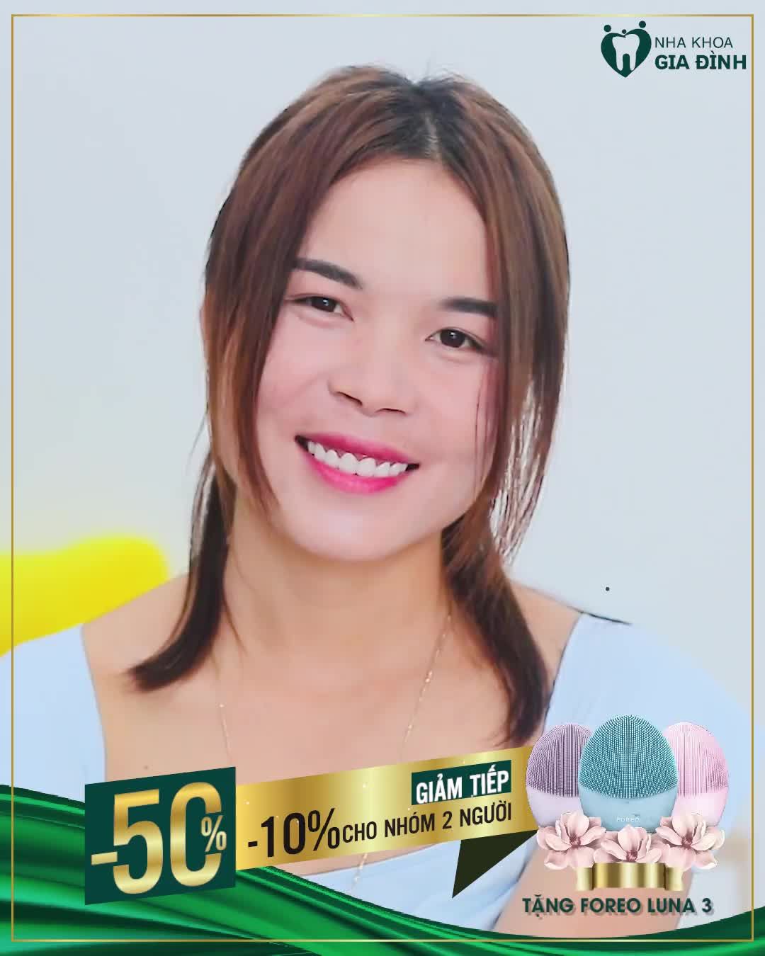 Và thanh xuân như trở lại với chị Hiền sau khi thực hiện thẩm mỹ răng sứ cao cấp.