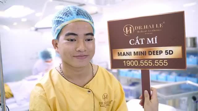 Cùng xem kết quả cắt mí Mani mini deep 5d của một vị khách hàng còn rất trẻ tuổi tại Dr. Hải lê