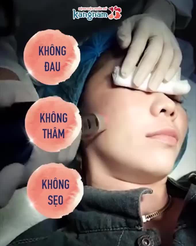 Trị nám Kangnam - Đã trị là HẾT