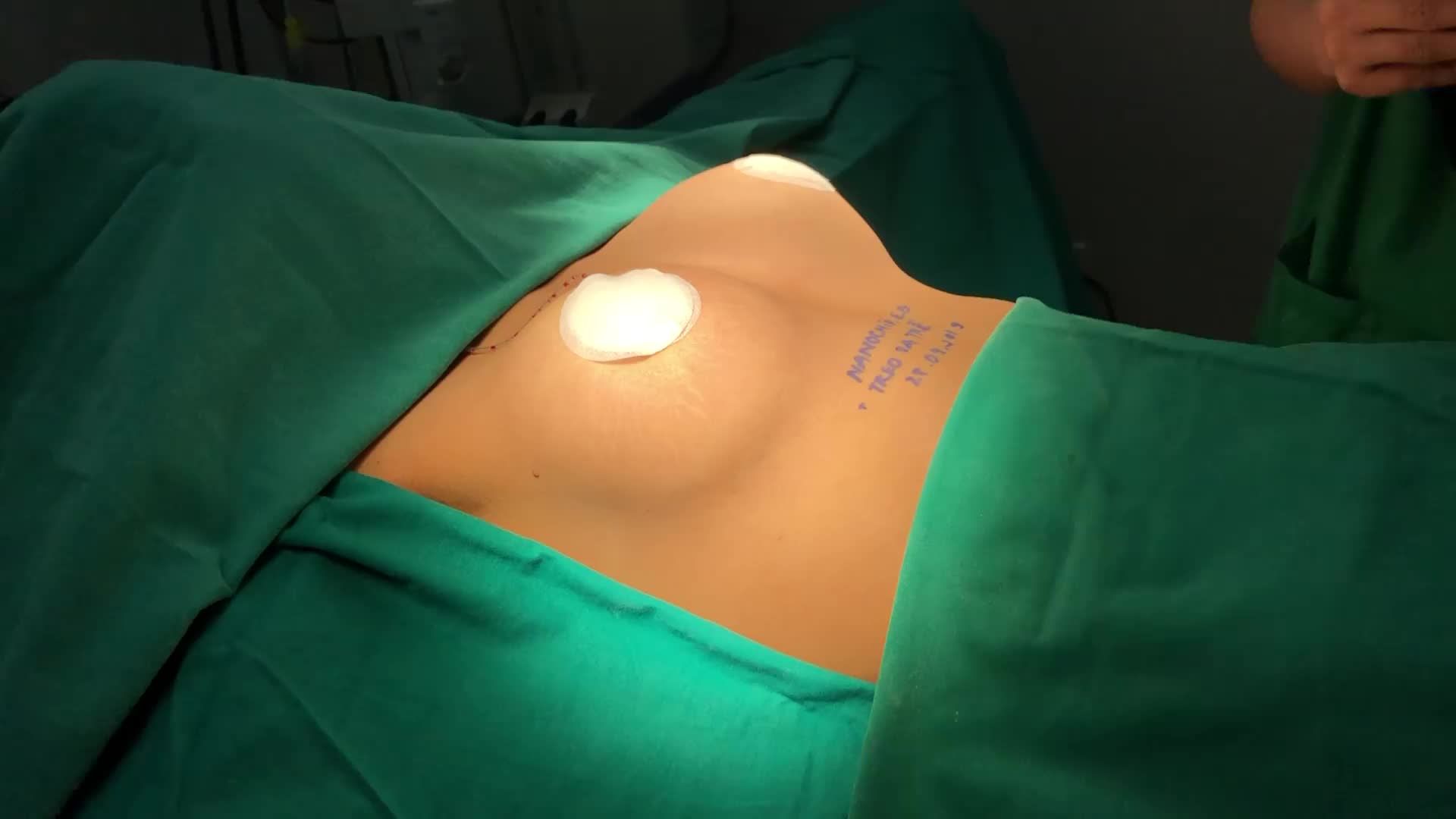 CA NÂNG CẤP VÒNG 1 ĐƯỢC THỰC HIỆN BỞI EKIP Thẩm Mỹ Bệnh Viện Bắc Hà