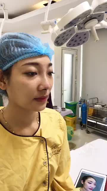 Cùng xem sự thay đổi sau khi nâng mũi demi 5Dkết hợp bọc sụn tại đẹp hoàn hảo mọi góc nhìn