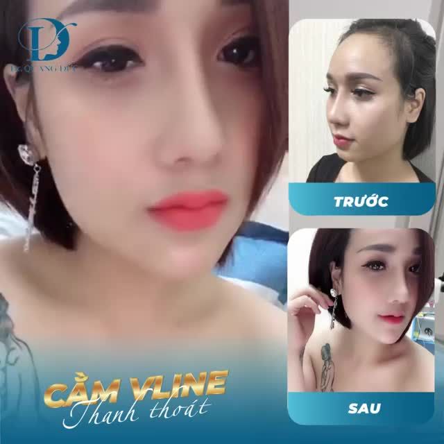 CẰM VLINE LÊN DÁNG CỰC SANG NGAY SAU KHI LÀM