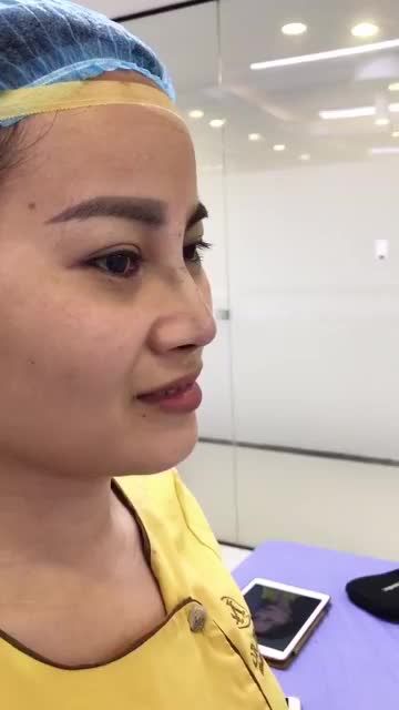 Không tin vào mắt mình sau nâng mũi Demi 5D tại Dr.Hải Lê