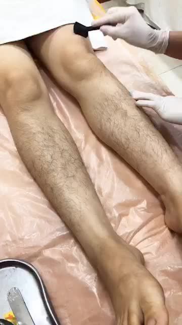 SIÊU PHẨM TRIỆT LÔNG DIODE LASER TẠI KANGNAM