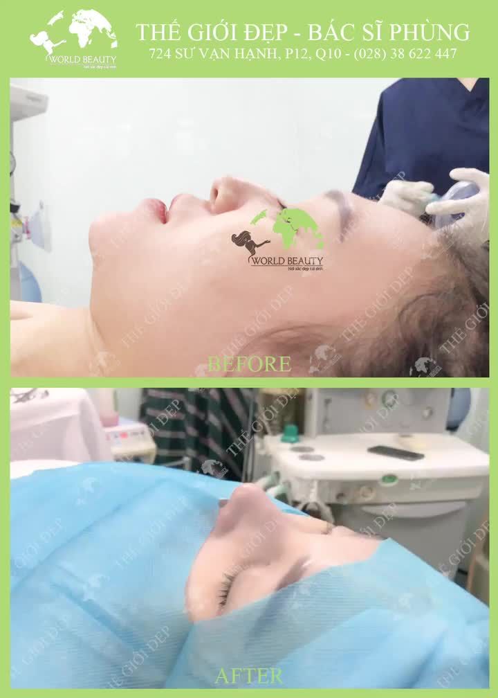 MŨI GỒ có tốt cho phong thủy không