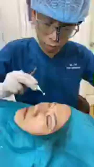 CẬN CẢNH CẮT DA DƯ MÍ MẮT +LẤY MỠ TỰ THÂN GIÚP ĐÔI MẮT LỘT XÁC RÕ RỆT