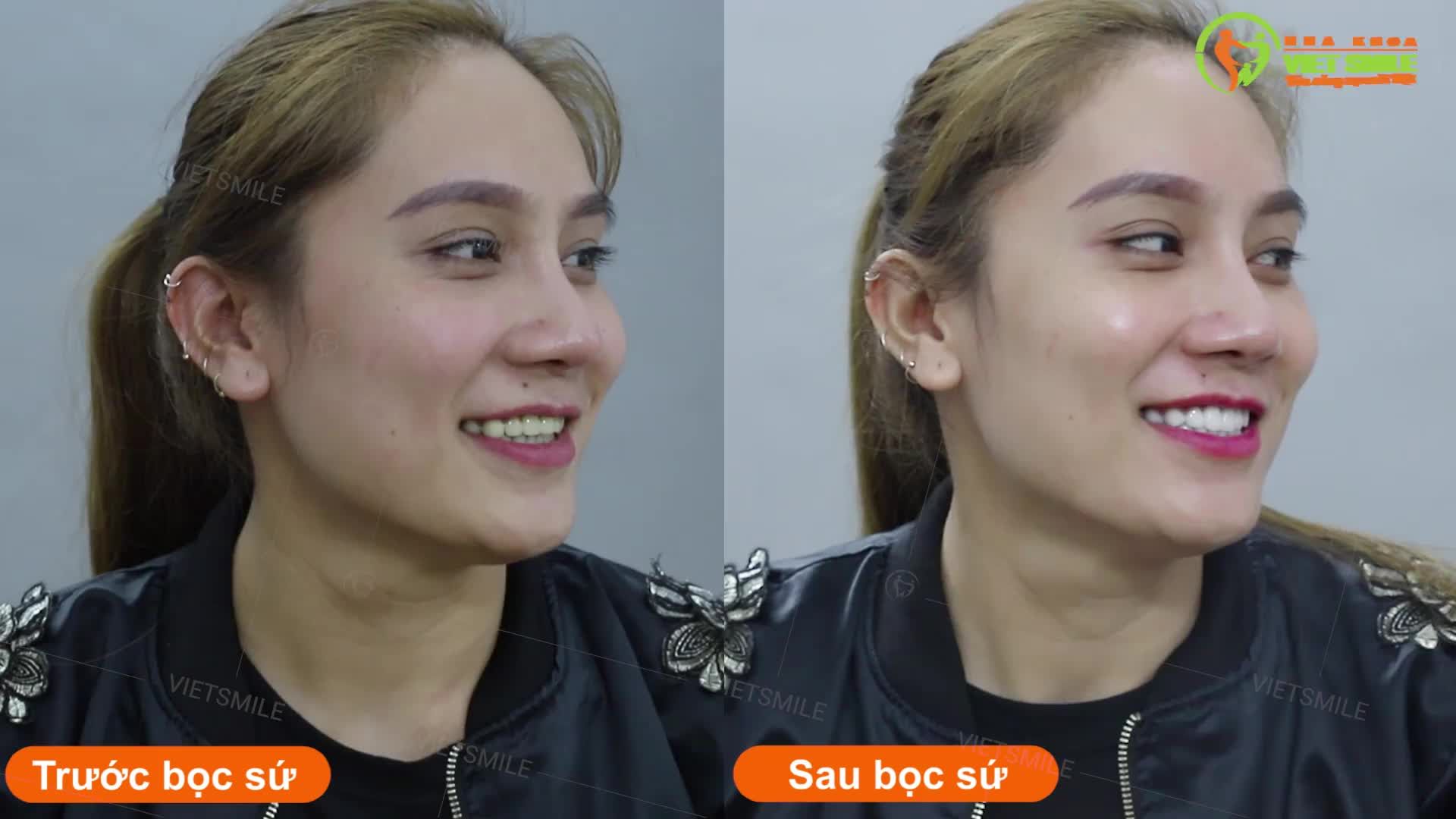 ĐẸP HƠN, HẠNH PHÚC HƠN - VÌ BẠN XỨNG ĐÁNG