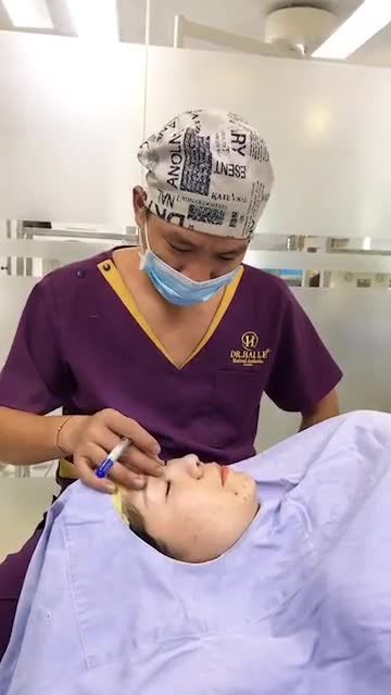 Cùng bs phân tích dáng mũi hài hoà đạt tỉ lệ vàng khuôn mặt