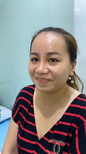 Đừng tin những gì Thẩm mỹ NamSan nói, trước khi nâng mũi, hãy nghe khách hàng nói gì về nâng mũi ở NamSan!
