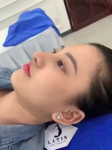 Fans mũi sụn sườn đừng bỏ lỡ