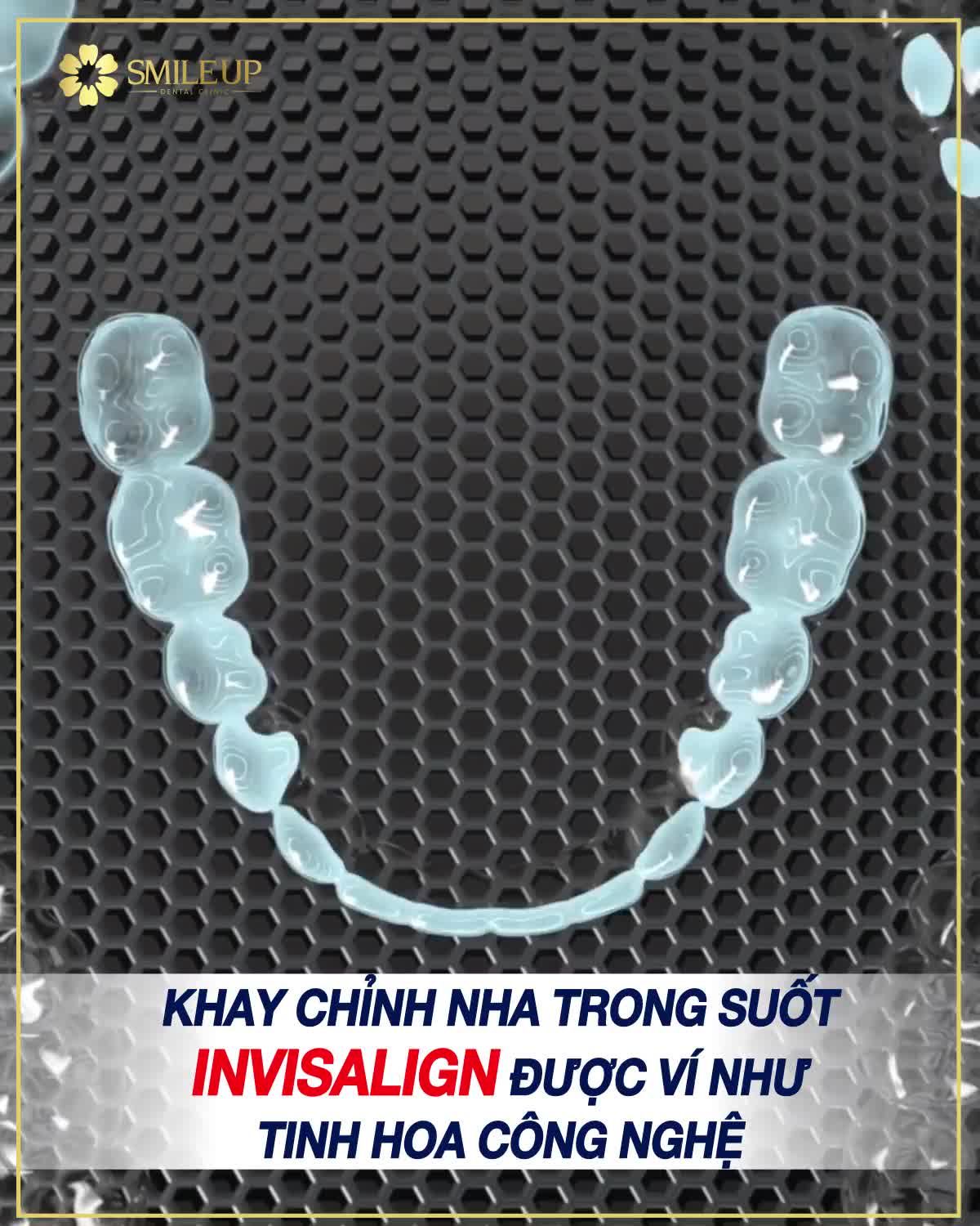 MUỐN NIỀNG RĂNG NHƯNG KHÔNG MUỐN GỌI LÀ "HÀM RĂNG SẮT".