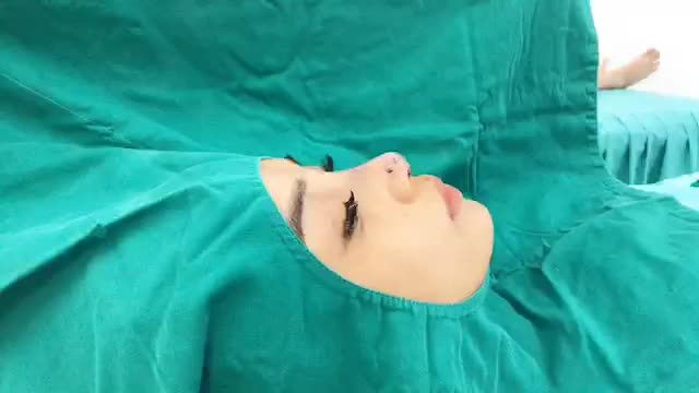 NÂNG MŨI BỌC SỤN