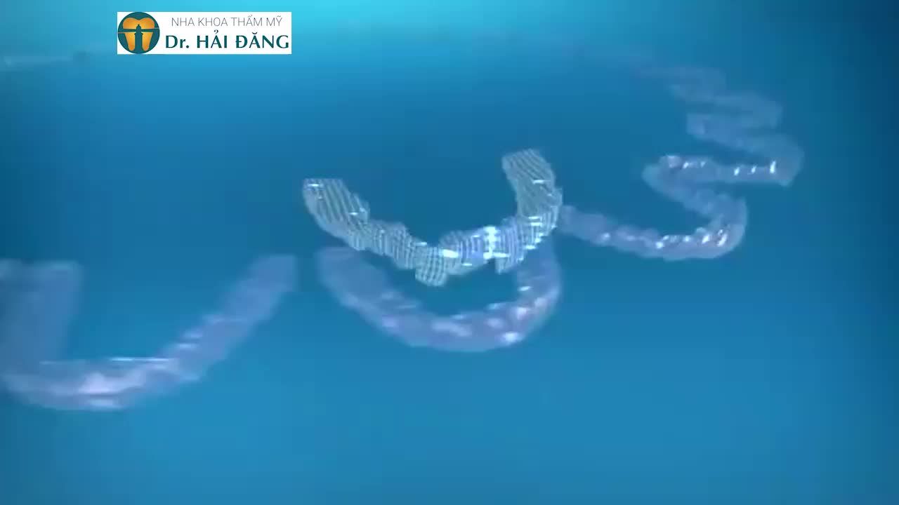 NIỀNG RĂNG TRONG SUỐT - TỰ TIN NỤ CƯỜI TƯƠI