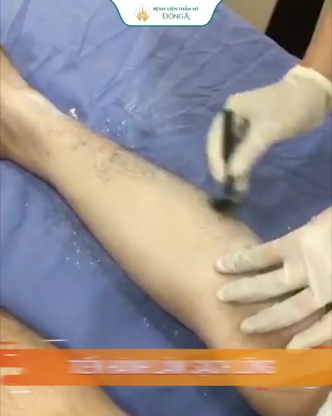 Lông chân DÀY - RẬM như đàn ông khiến KH mất tự tin