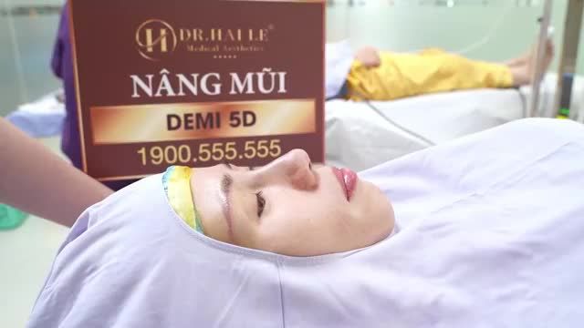 Cùng chiễm ngưỡng sự thay đổi đến bất ngờ của một vị khách hàng vừa nâng mũi Demi 5D tại Dr. Hải Lê xong!