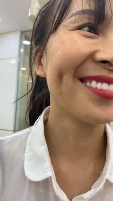 Kết quả đáng kinh ngạc sau 4 tháng Thẩm mỹ răng sứ của nữ khách hàng