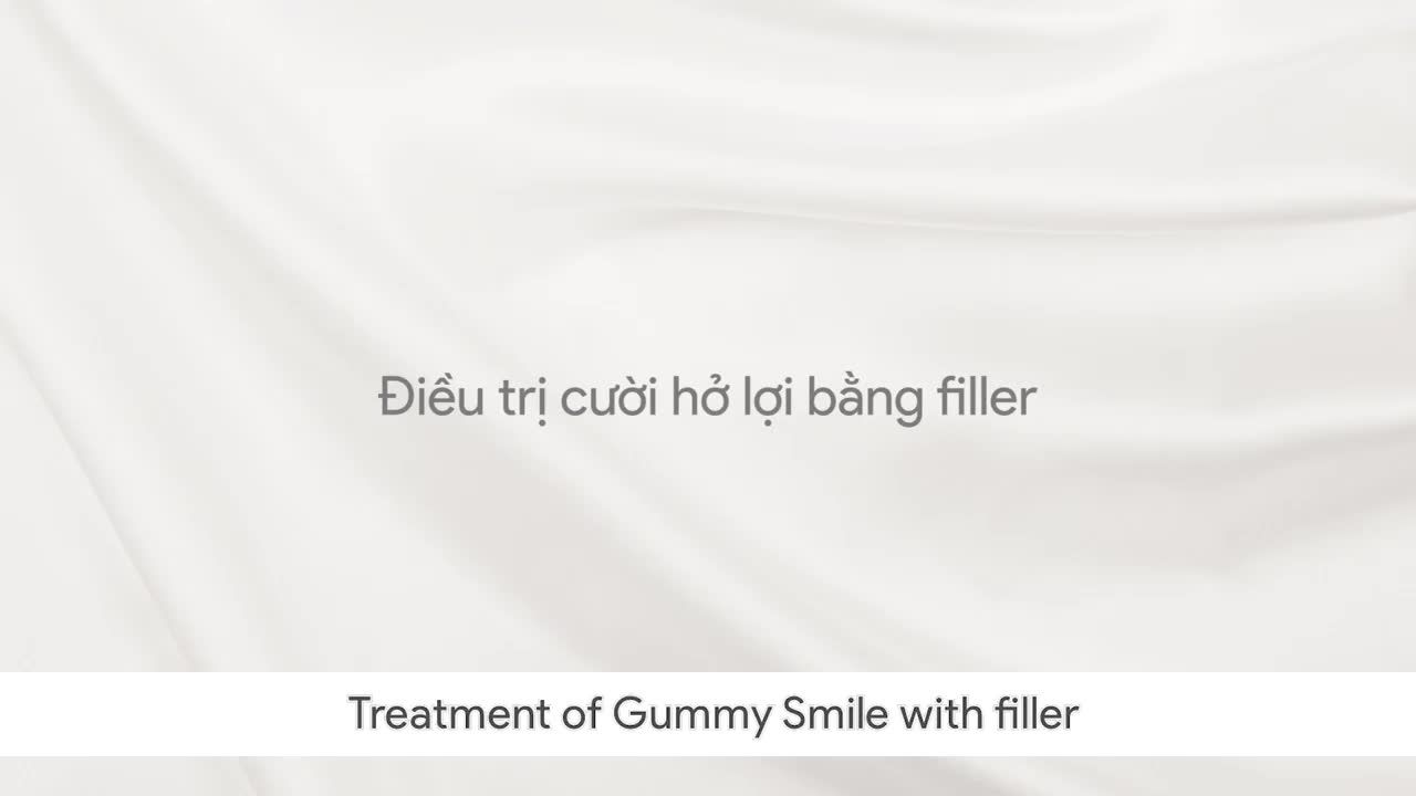 KHẮC PHỤC CƯỜI HỞ LỢI, TRẢ LẠI NỤ CƯỜI RẠNG RỠ