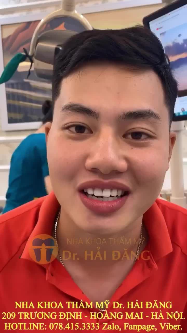 Những chiếc răng cửa to thô, to dị dạng thừa, mất cân đối làm bạn mất tự tin Khi giao tiếp