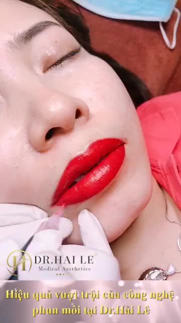 LO SỢ PHUN MÔI SẼ "ĐAU RÁT, SƯNG NỀ" GÂY KHÓ CHỊU