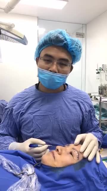 Quá trình bác sĩ đo vẽ trước khi thực hiện dịch vụ Nâng cung chân mày cho khách hàng nước ngoài
Mời các bạn cùng theo dõi