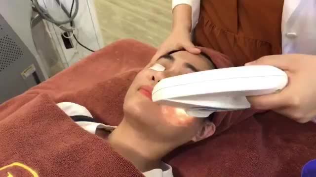 Cùng xem quy trình điều trị tàn nhang 1 lần duy nhất bằng công nghệ Laser Spectra – Elos