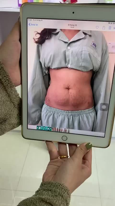 NHÌN NHƯ HÓP MÀ KHÔNG PHẢI HÓP