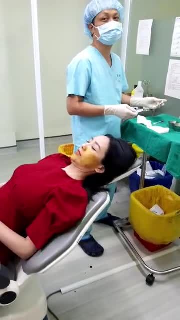 Tiêm giải filler mặt trước khi hóa thành công chúa