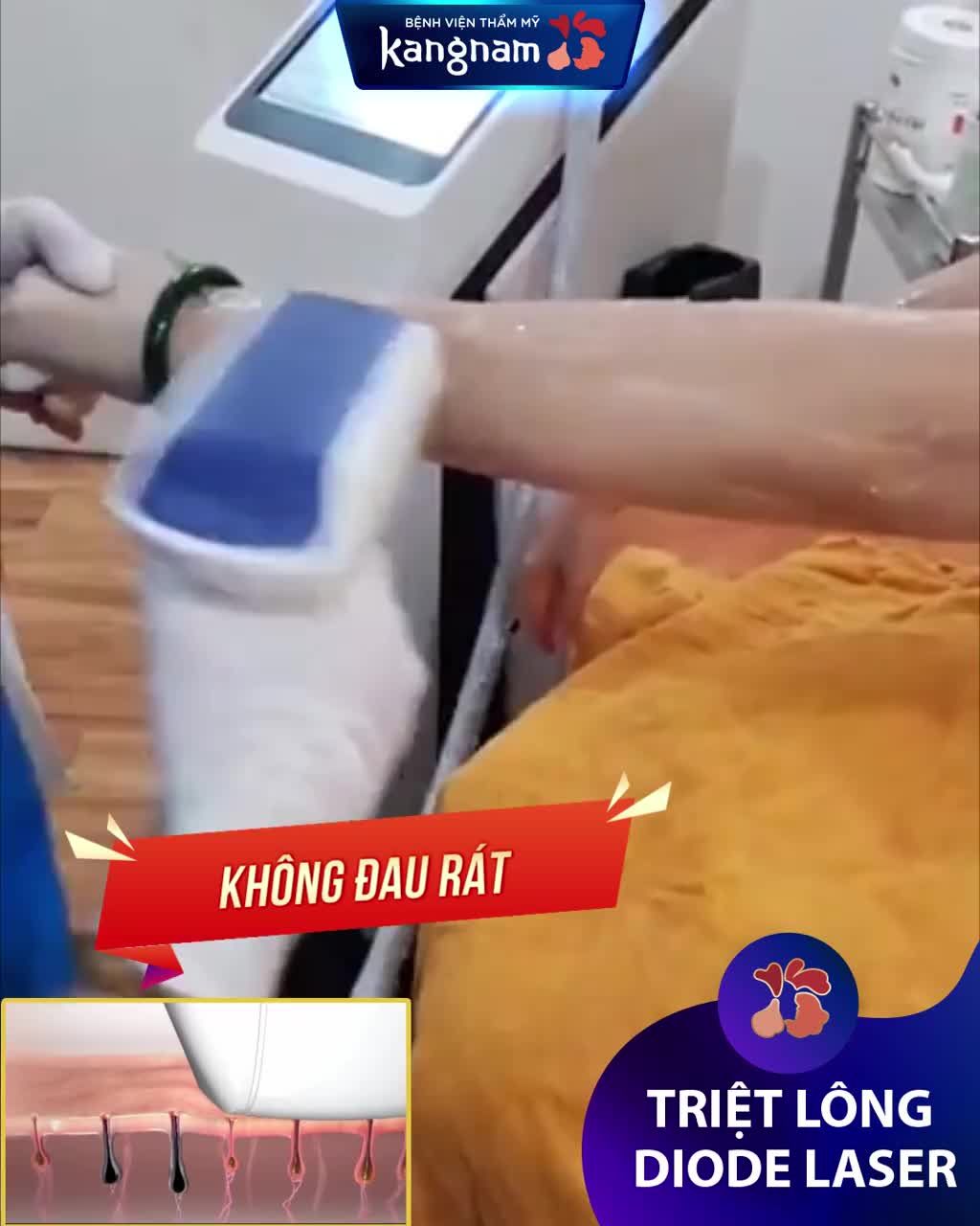 Nỗi ám ảnh tay con gái mà LÔNG RẬM như con trai
